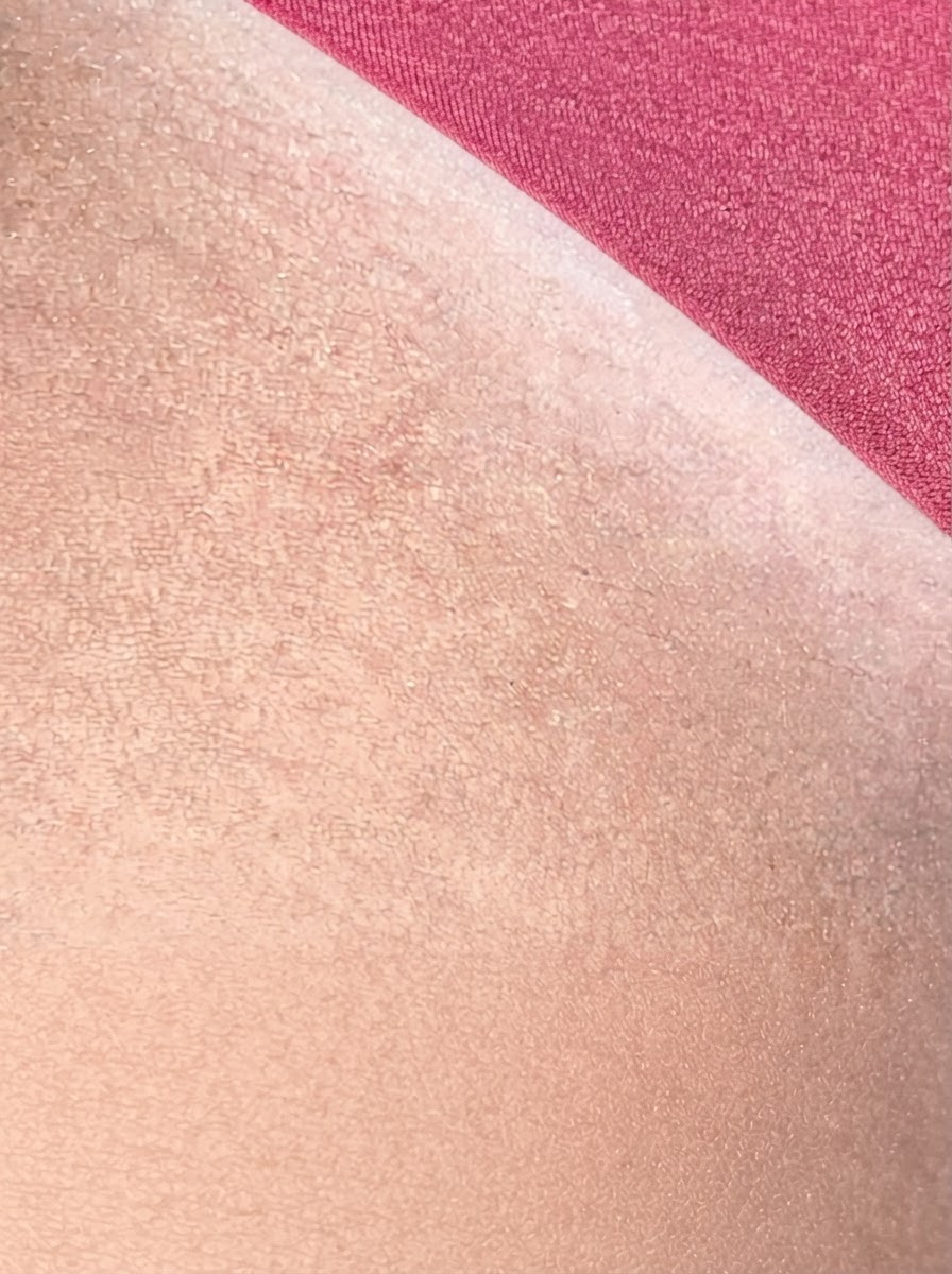Después — 2–4 weeks