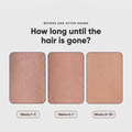 Before and after Naema: hair reduction over 12 weeks